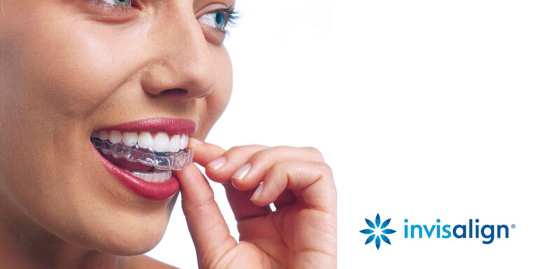 Does Dental Insurance Cover Invisalign?