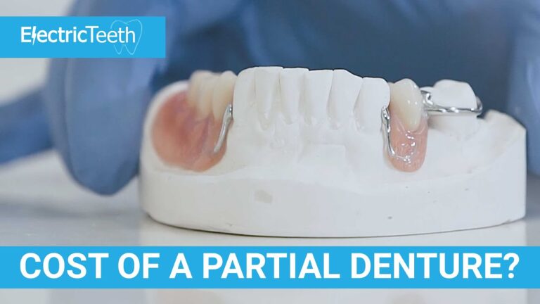 How Much Do Partial Dentures Cost Without Insurance?